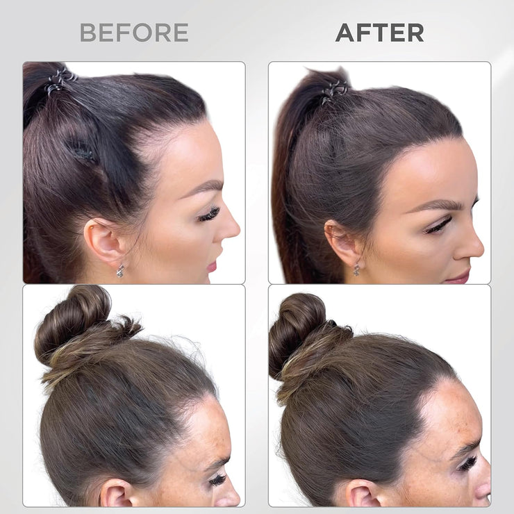 Hair Loss Instant Essential Mist Spray Natural Black Rice Water Hair Growth Spray for Women Men